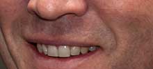 Guttenberg - Foto von Wikipedia (Ausschnitt seines Mundes, mit dem er beteuert, dass er nicht bewusst getäuscht habe)