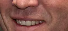 Guttenberg (Ausschnitt seines Mundes, mit dem er beteuert, dass er nicht bewusst getäuscht habe)